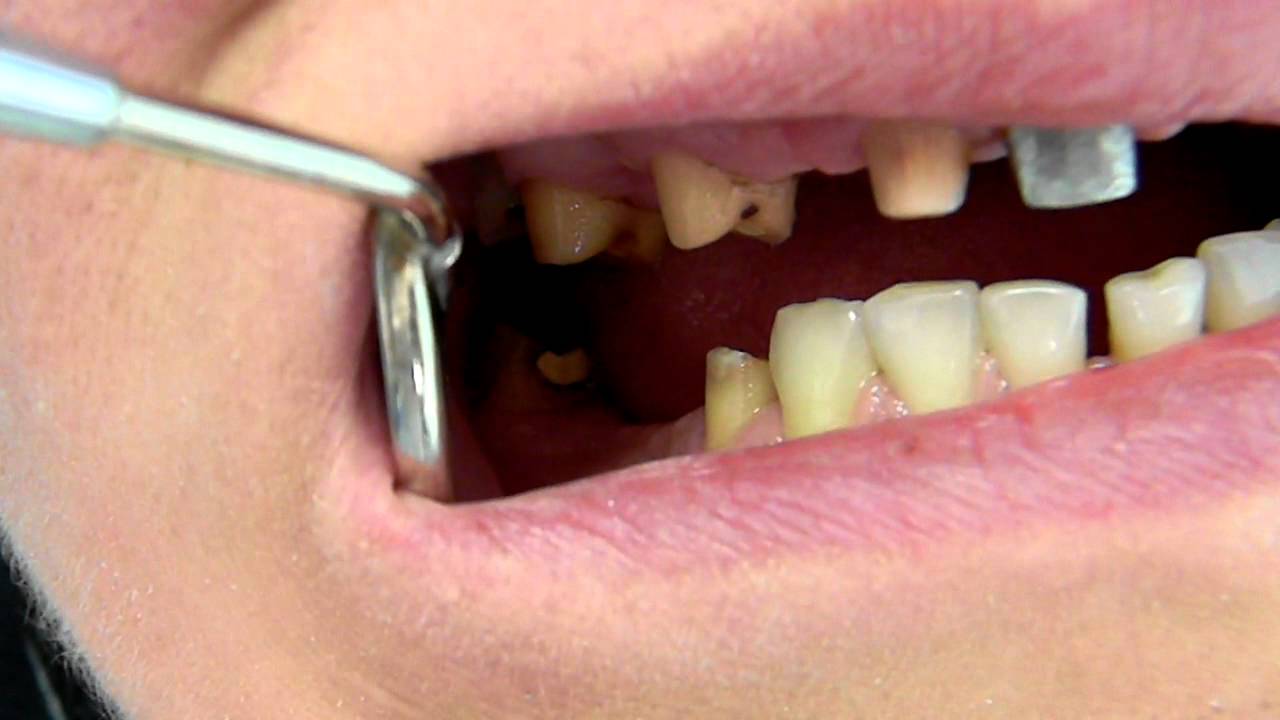 DSCN1527.MOV