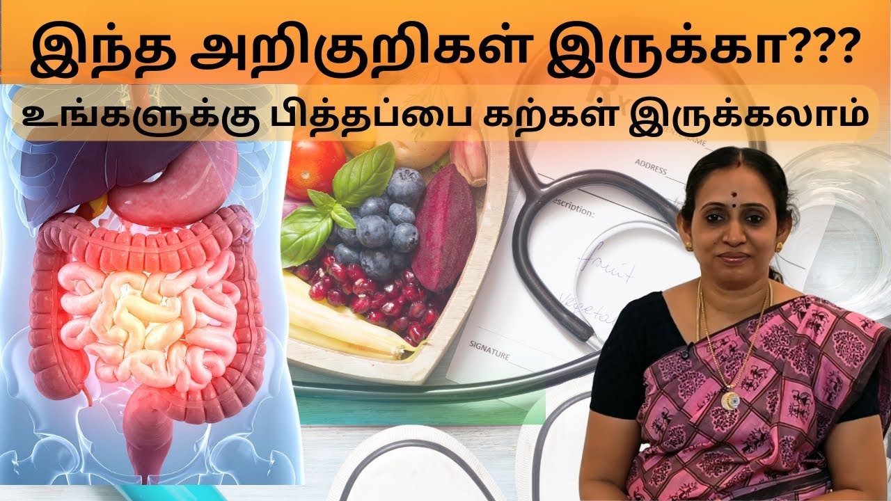 Gall Stones Management through Naturopathy & Yoga #drpreethipushkarini #naturopathydoctorintrichy