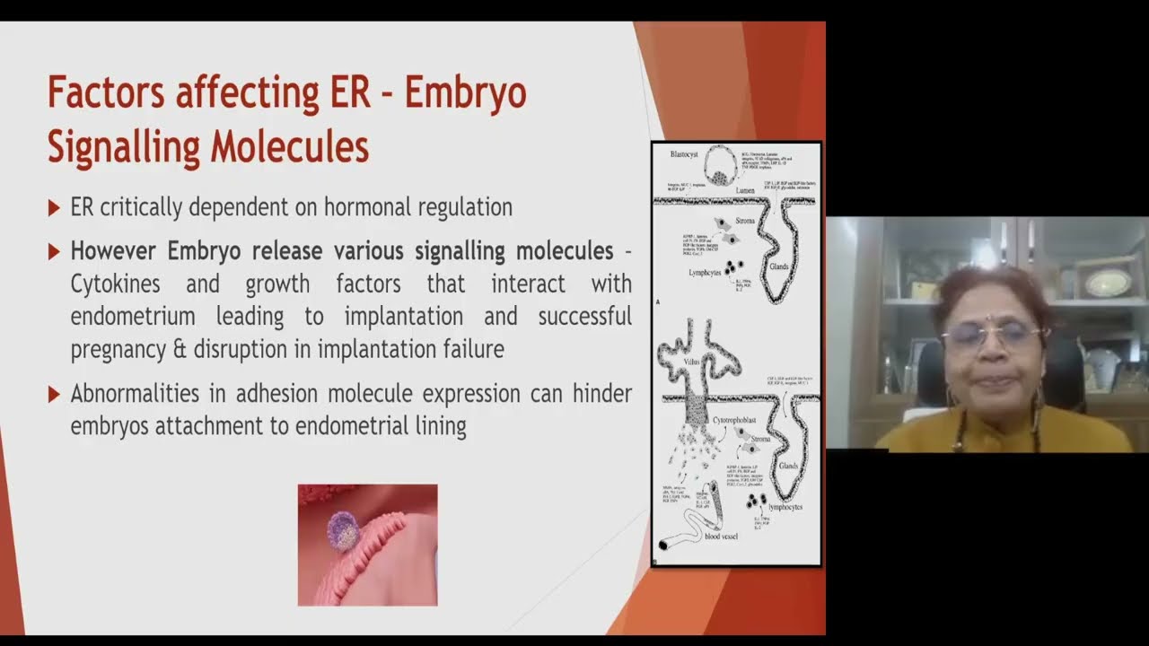 DR Sadhana Gupta - Optimizing Endometrial Receptivity