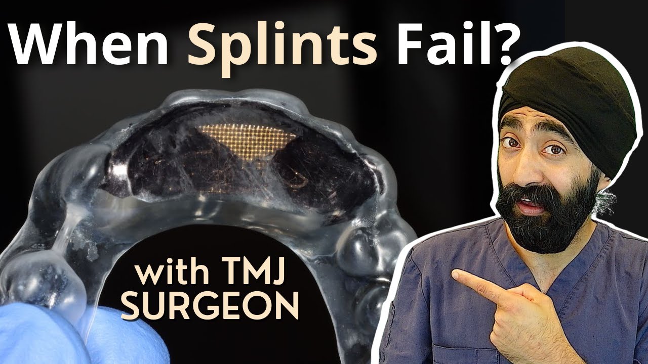 What Happens When Occlusal Splints Don't Work - PDP118