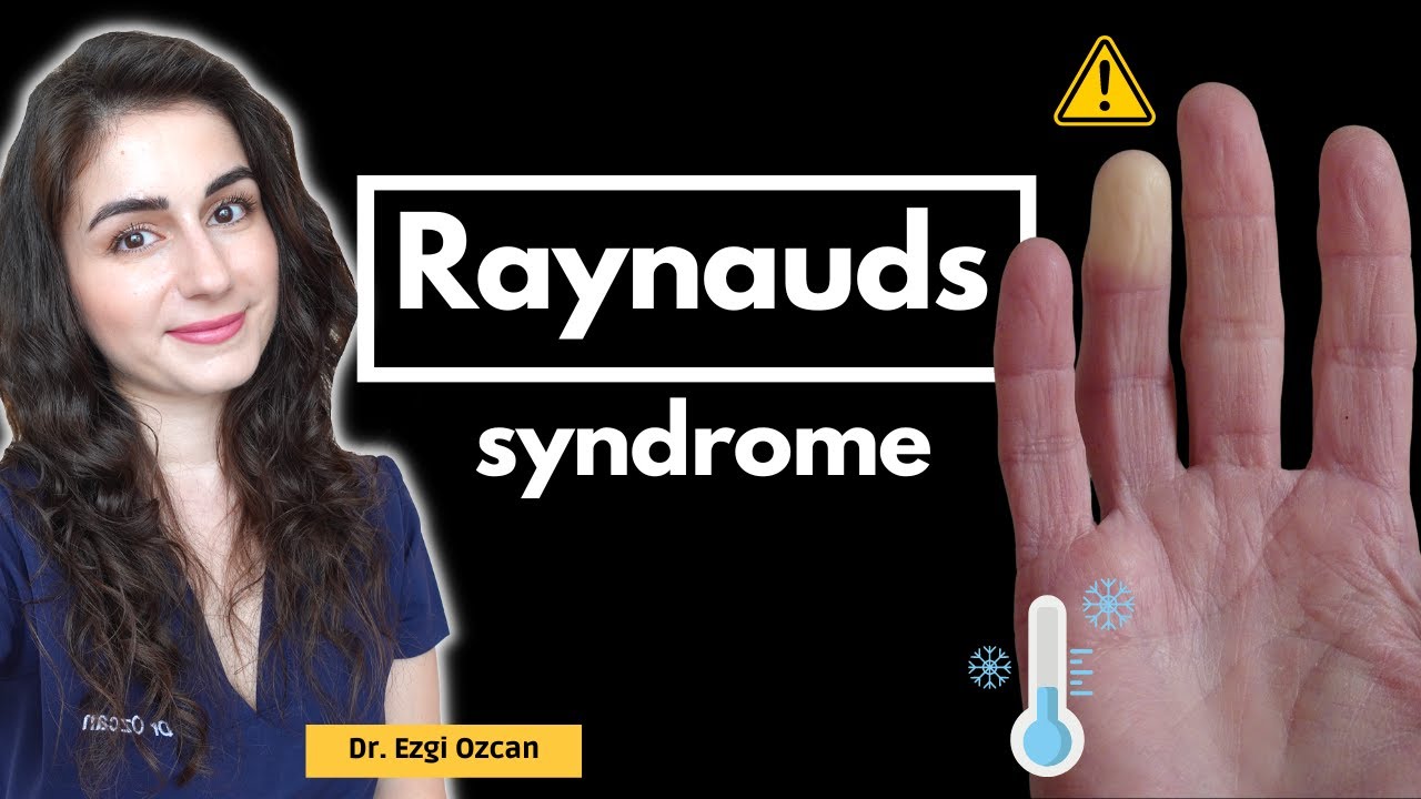 Raynaud's Syndrome: Causes, Symptoms, and Effective Management