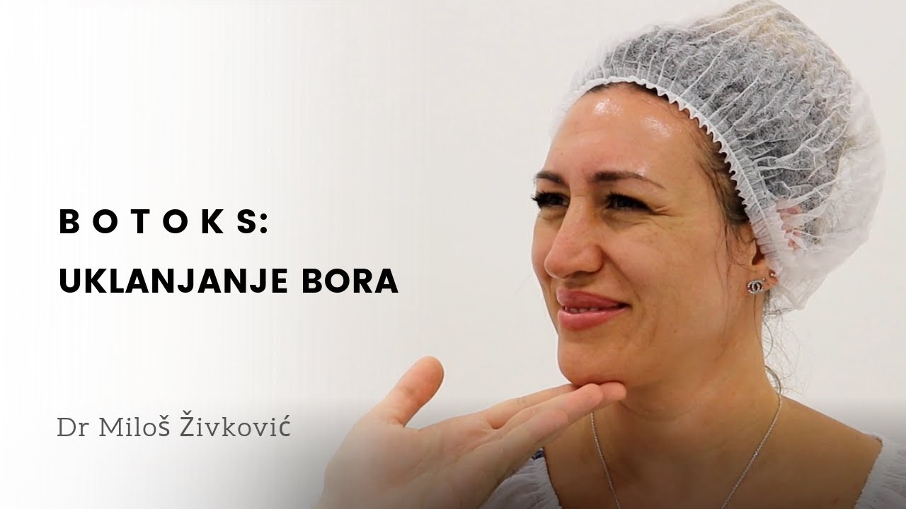 Uklanjanje bora na čelu botoksom | Dr Miloš Živković