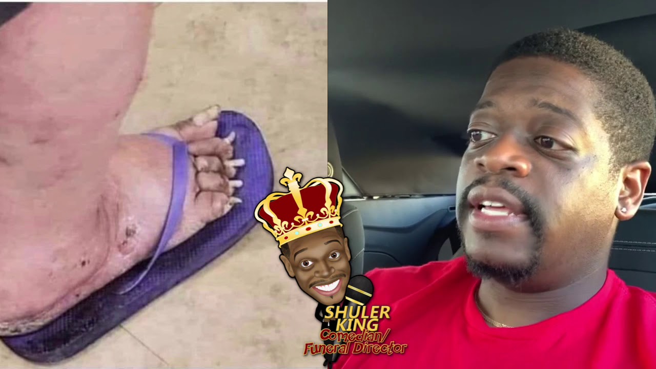 Shuler King - Who’s Foot Is This?!!!
