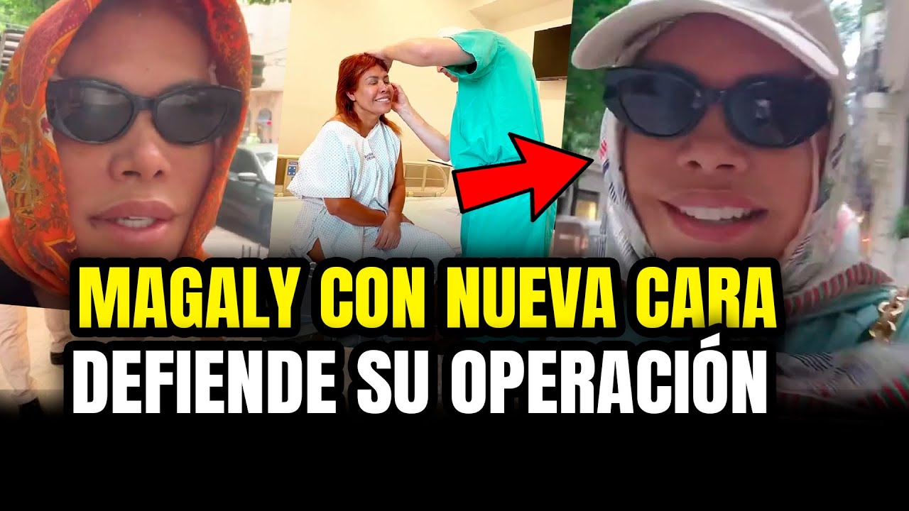 MAGALY MEDINA DEFIENDE su OPERACIÓN DE ROSTRO ¡15 AÑOS MENOS!