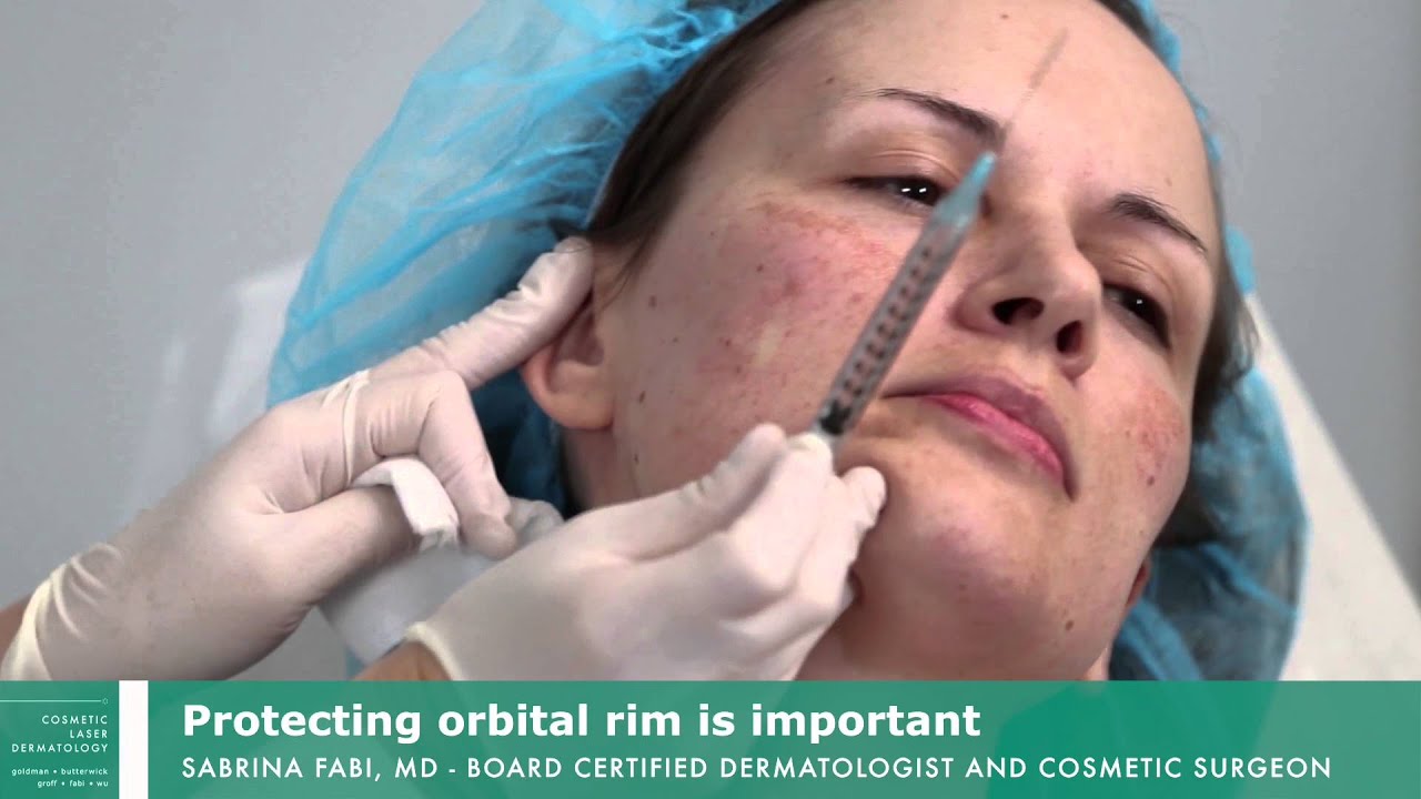 Sculptra of the Midface with Dr. Fabi | 858-314-9244