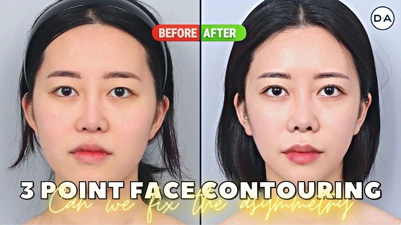 [Plastic Surgery Korea] Can 3 Point face Contouring Fix My Asymmetry?