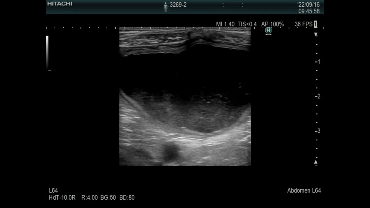 bladder, urethral stones, Pocket size VS stationary high-end system echo images, dog(8kg)