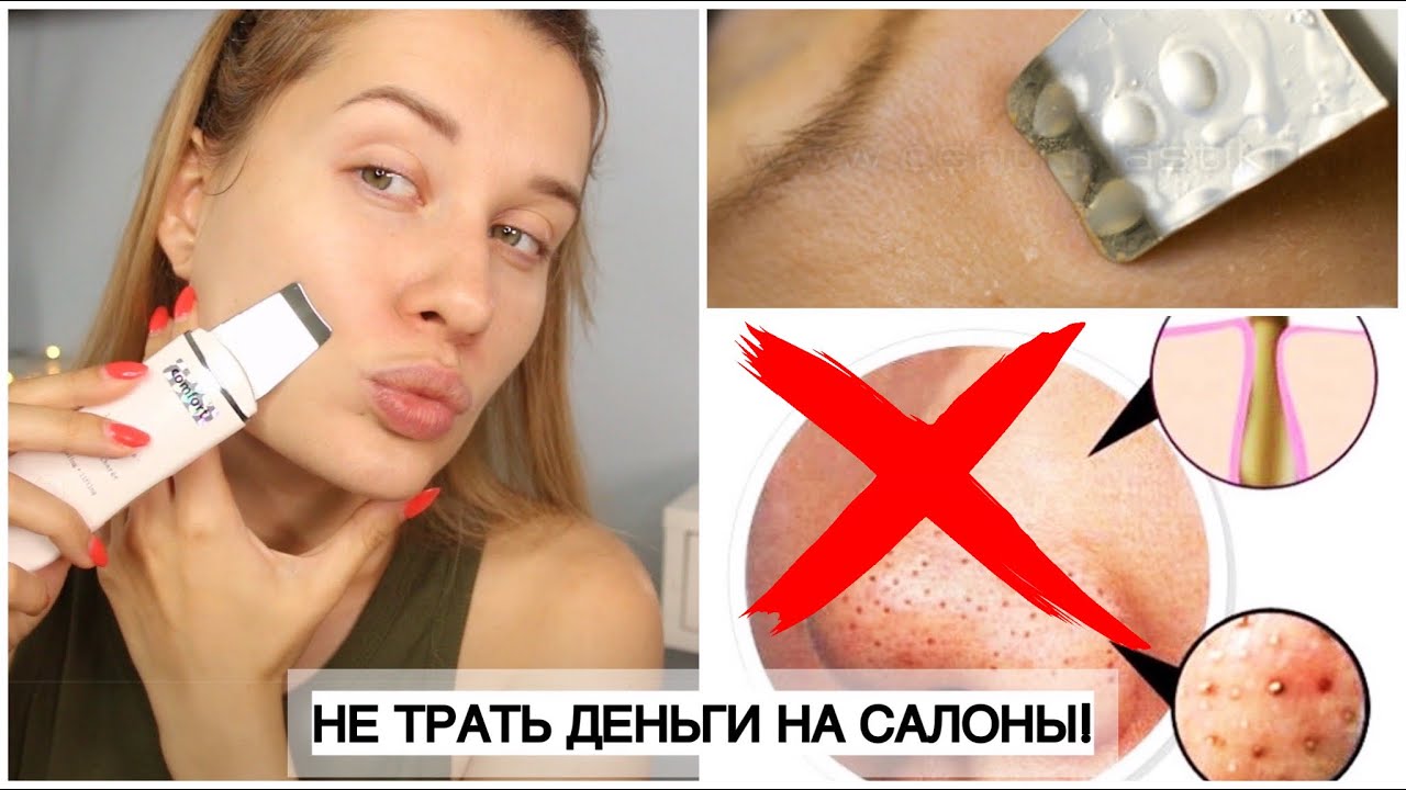 КАК СДЕЛАТЬ УЛЬТРАЗВУКОВУЮ ЧИСТКУ ЛИЦА ПРАВИЛЬНО В ДОМАШНИХ УСЛОВИЯХ