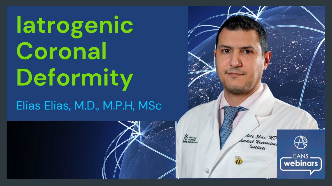 Iatrogenic Coronal Deformity - Elias Elias, MD, MPH, MSc