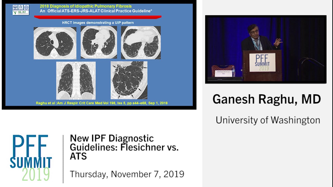 New IPF Diagnostic Guidelines: Fleischner vs. ATS | Ganesh Raghu, MD