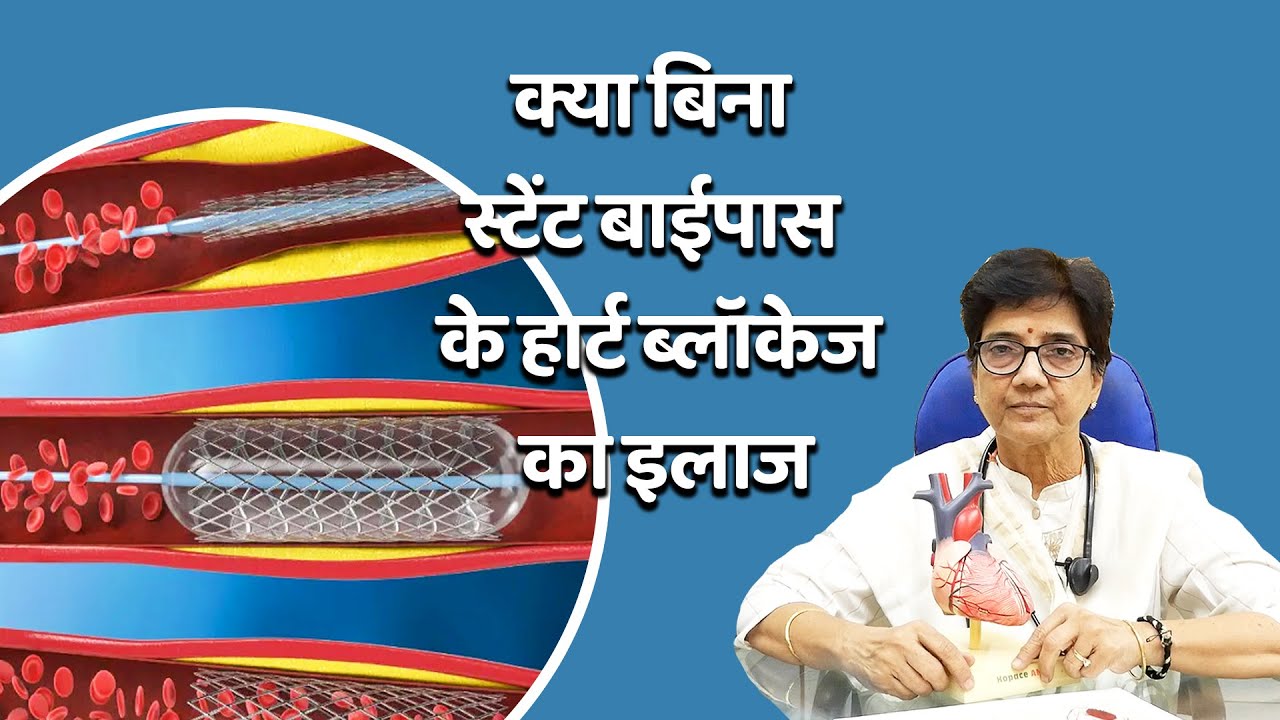 क्या बिना स्टेंट या बाईपास के हार्ट ब्लाॅक खुल सकतें है...Dr Arati Dave Lalchandani