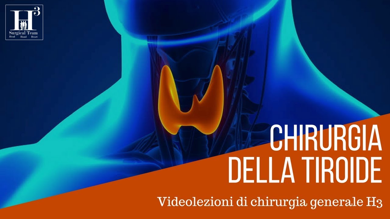 Chirurgia della tiroide