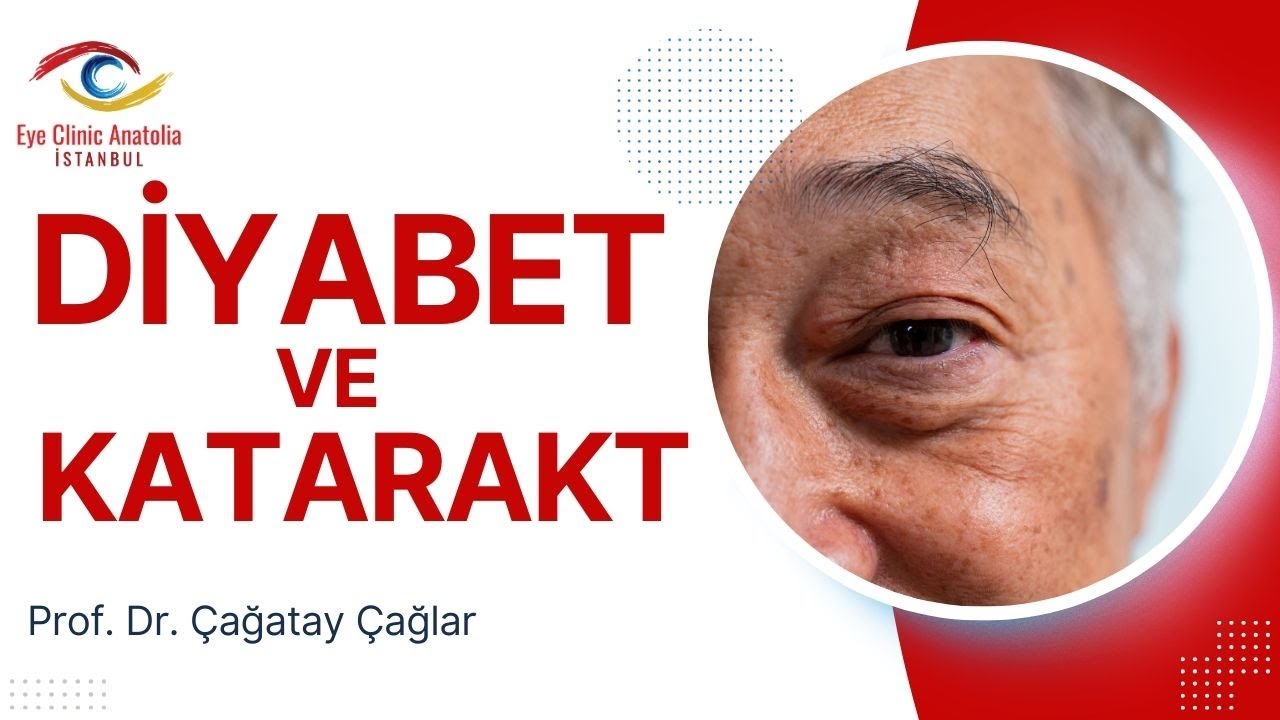 Katarakt Diyabetli Hastalarda Neden Erken Gözükür? / Dr. Çağatay Çağlar