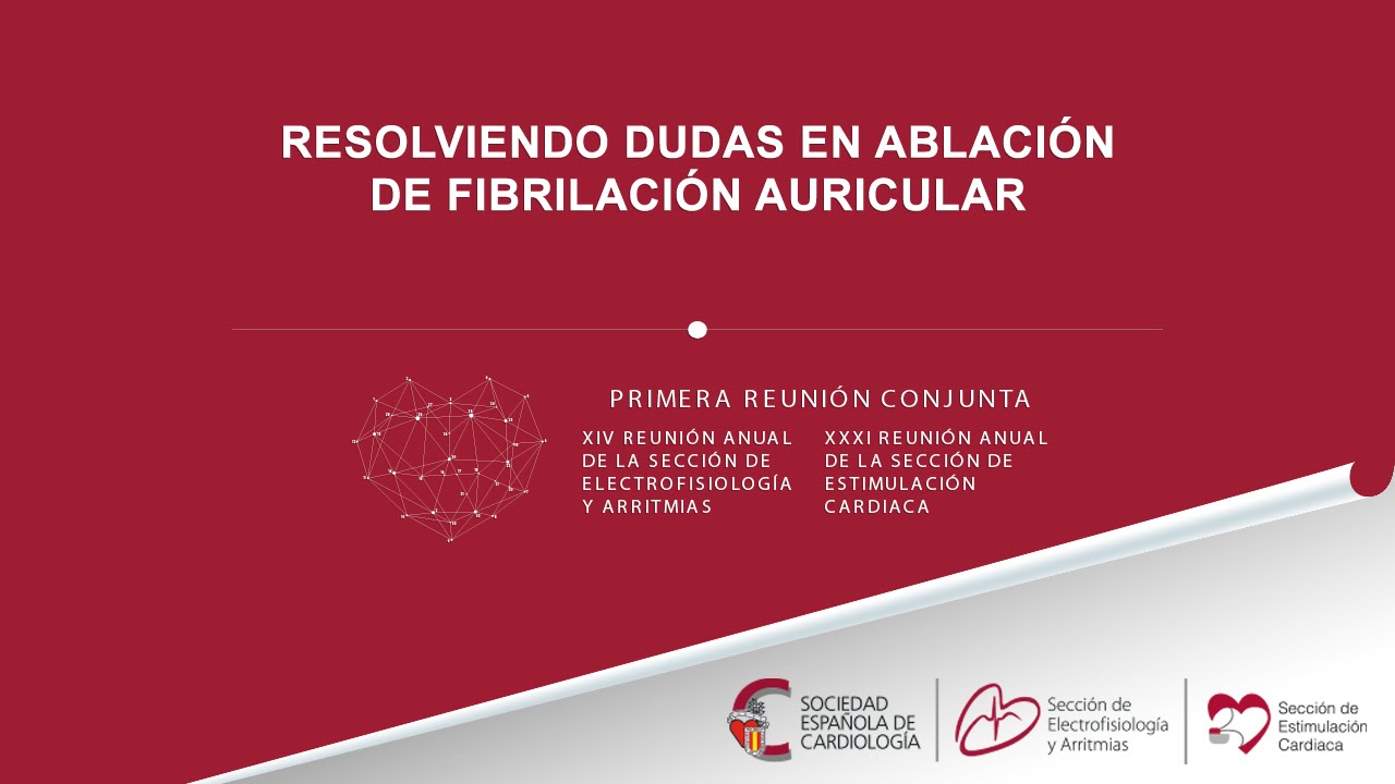 Resolviendo dudas en ablaci&oacute;n de fibrilaci&oacute;n auricular