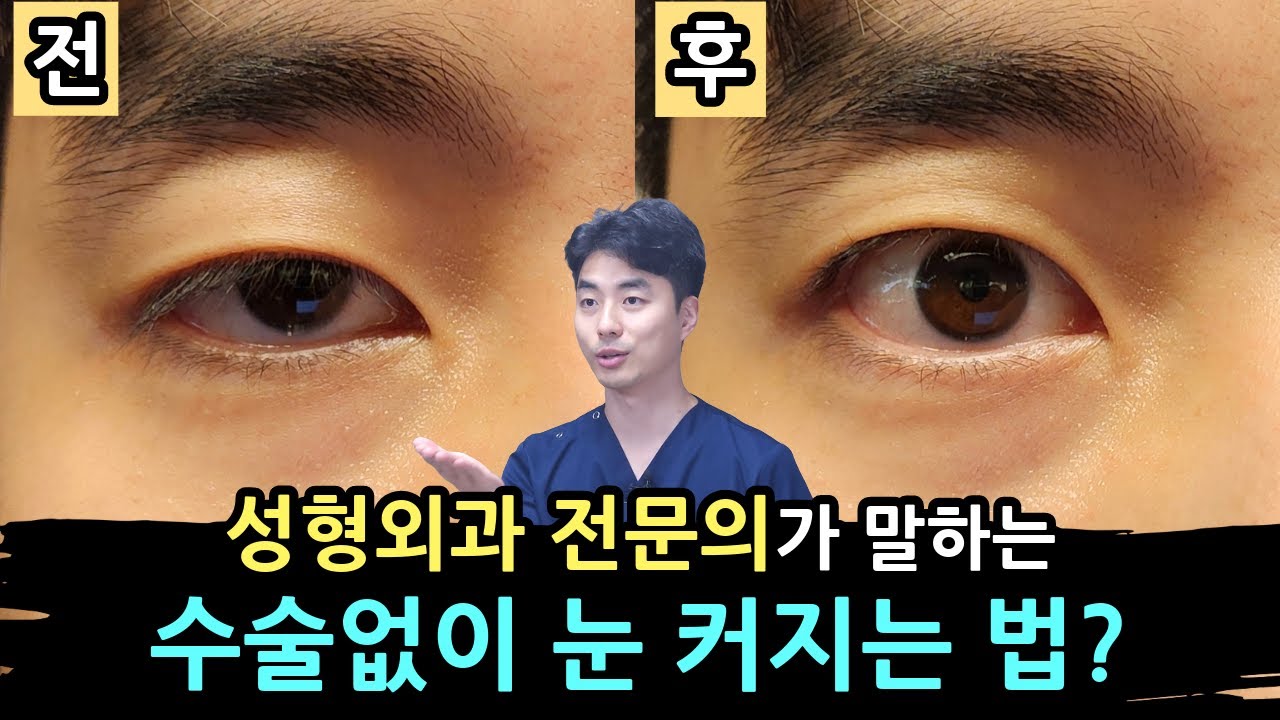 쌍수 눈매교정 없이 눈 커지는 법? - 성형외과 전문의가 말합니다.