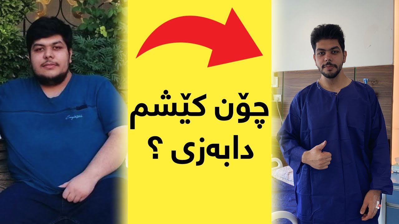 عەمەلیاتی چی کرام و توشی چی بووم لە کاتی عەمەلیاتەکە 🤔