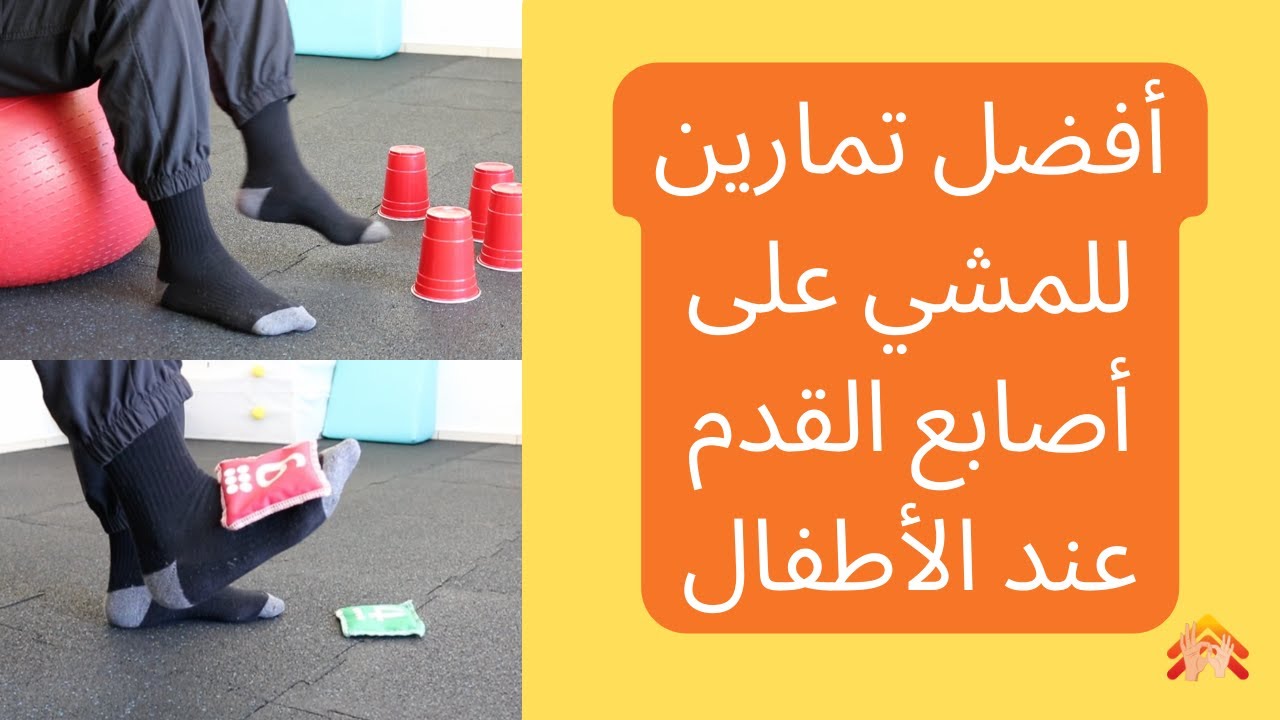 العلاج الطبيعي للمشي على أصابع القدم عند الأطفال [أفضل التمارين العلاجية]