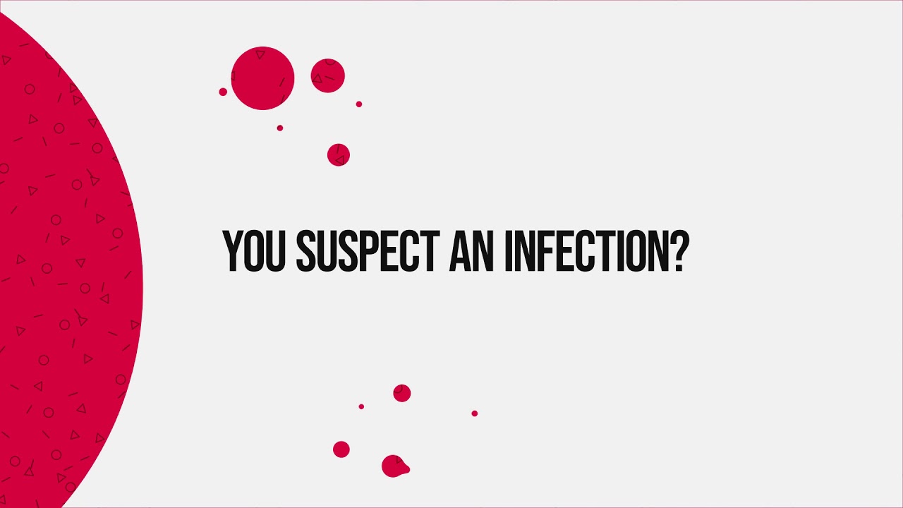 How to prevent coronavirus infection?