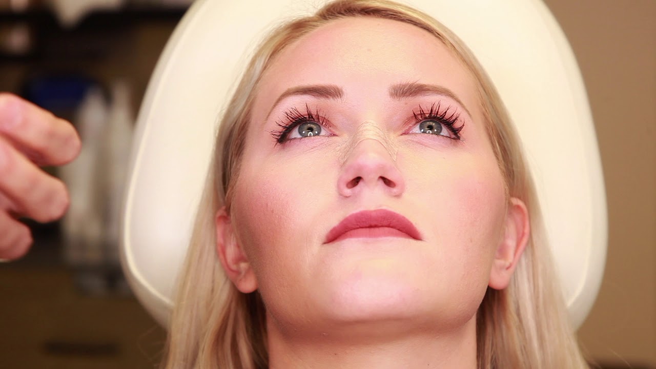 How to tape your nose post Rhinoplasty