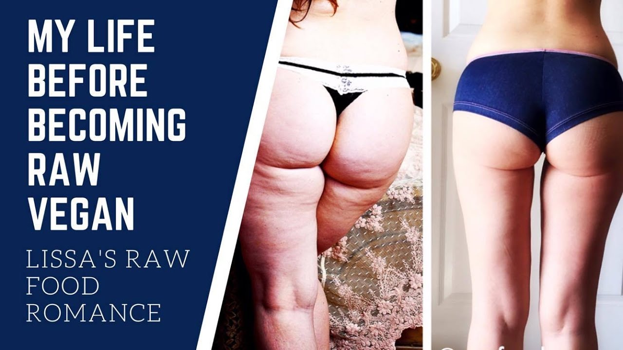 MY LIFE BEFORE RAW VEGAN || WEIGHT LOSS HEALTH JOURNEY