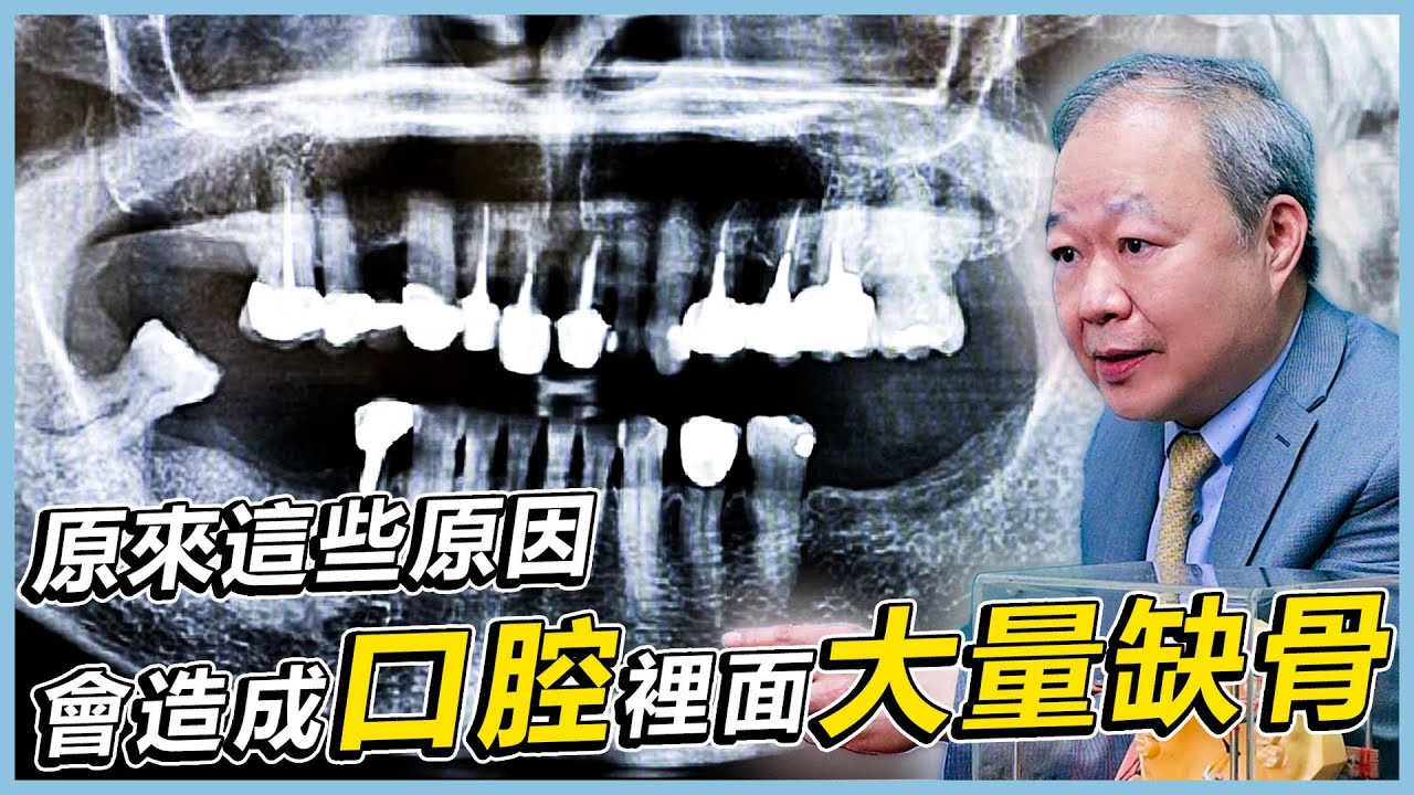 【植牙常識這裡看！植牙專業朱裕華醫師來講解！EP.1】齒槽骨缺損是什麼原因造成？  #注意 #健康