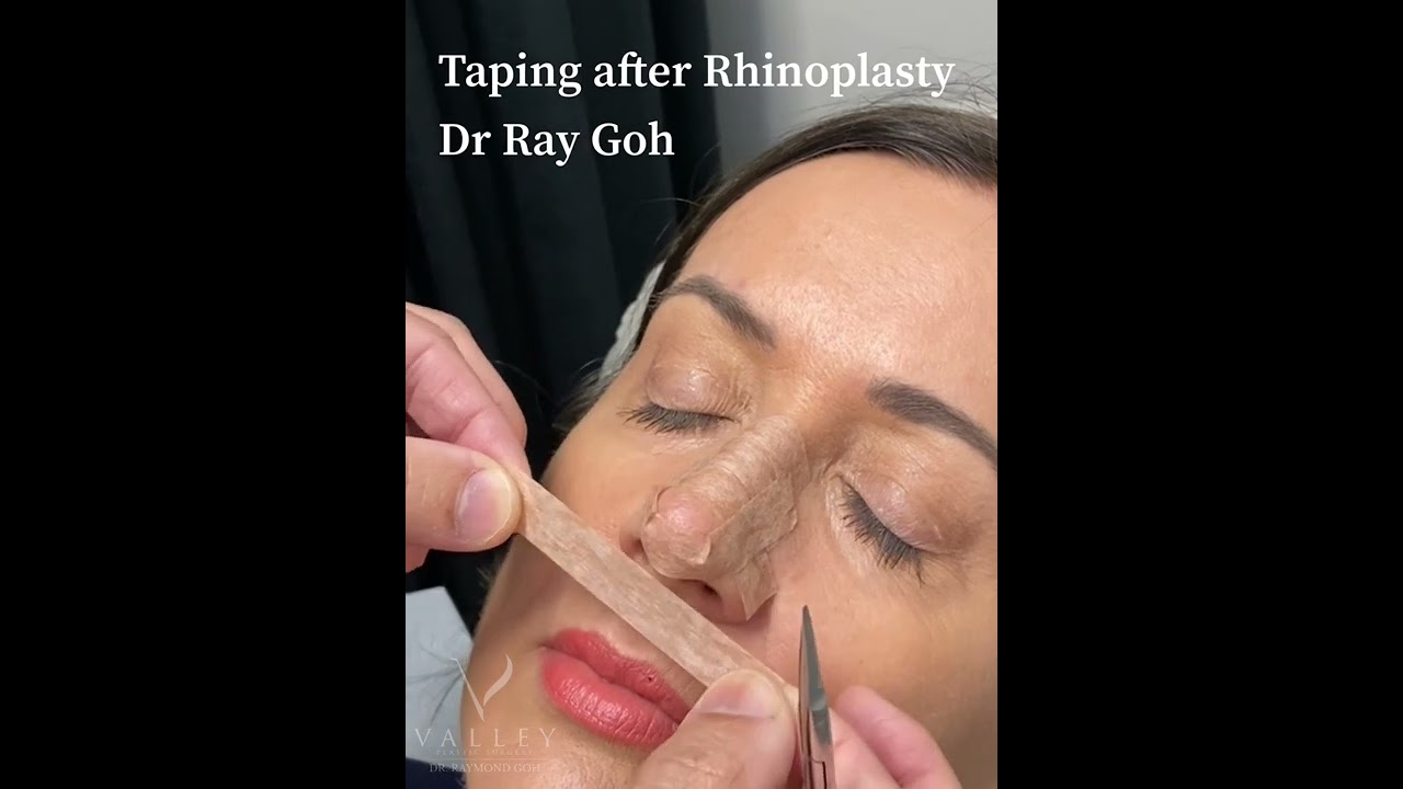 VPS Training - Rhinoplasty post-op taping tutorial