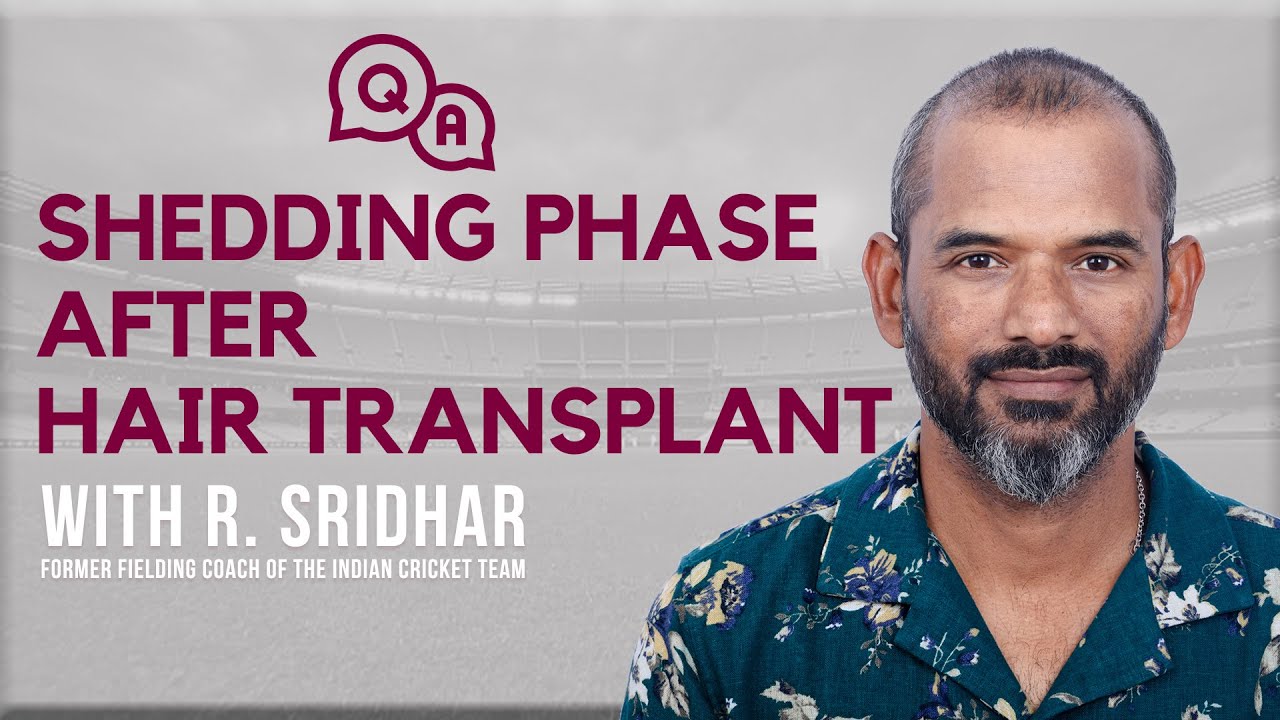 Shedding Phase After Hair Transplant: Coach R. Sridhar's Take on Hair Transplant Shedding