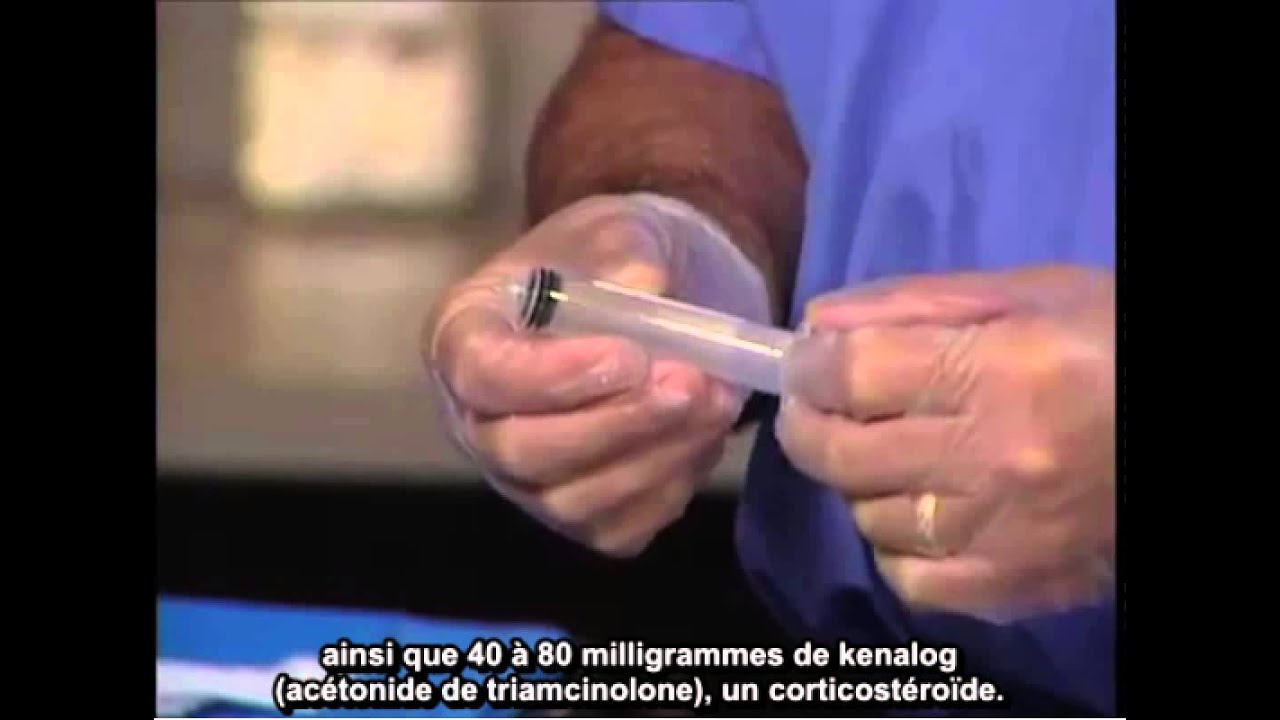 Comment : Réaliser une injection dans le piriforme par guidage échographique
