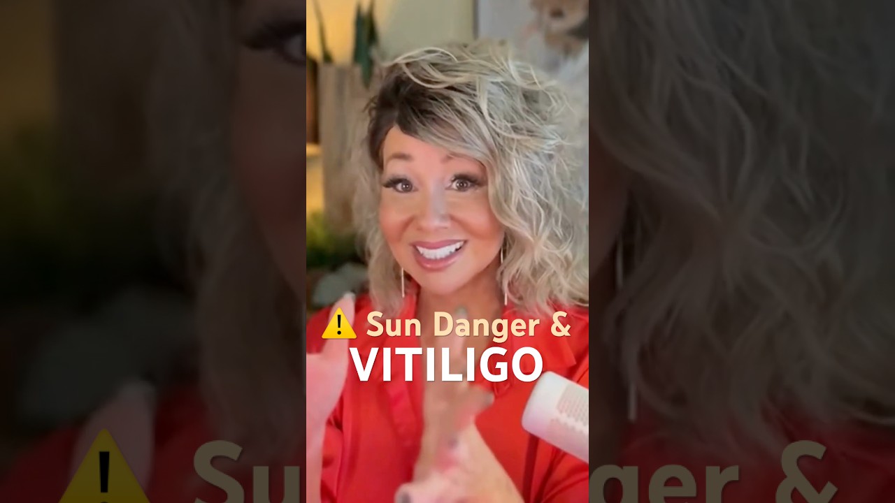 Dangers of The Sun And Vitiligo