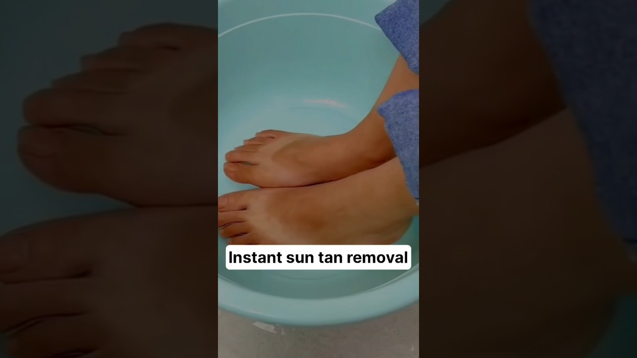 Slipper marks removal in 10 mins #shorts #viral #tanning #youtube