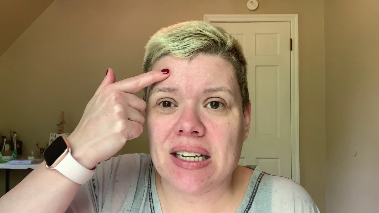 How I was diagnosed with IIH