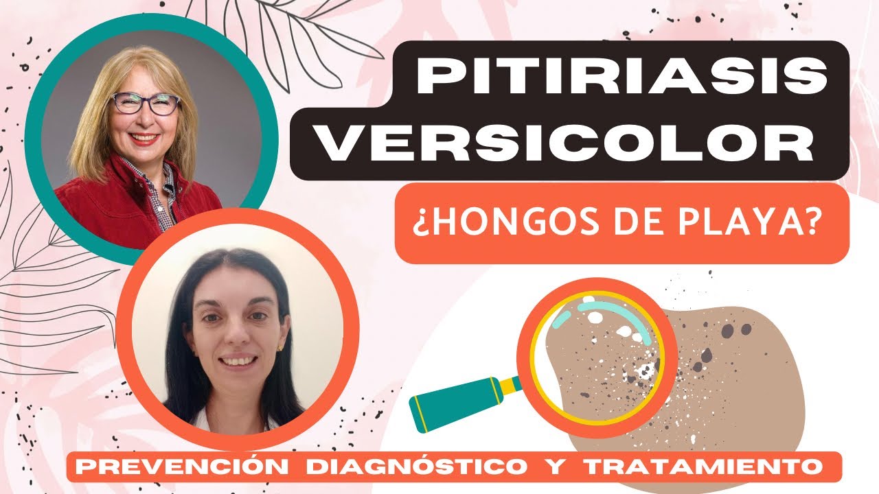 PITIRIASIS VERSICOLOR. ¿HONGOS DE PLAYA? ¿CÓMO SE CONTAGIAN? TRATAMIENTO. @depielapiel