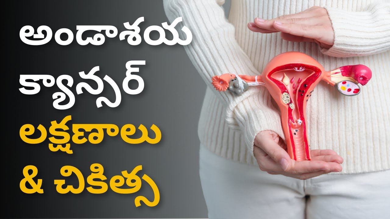 అండాశయ క్యాన్సర్ లక్షణాలు మరియు చికిత్స | Ovarian Cancer Symptoms & Treatments |