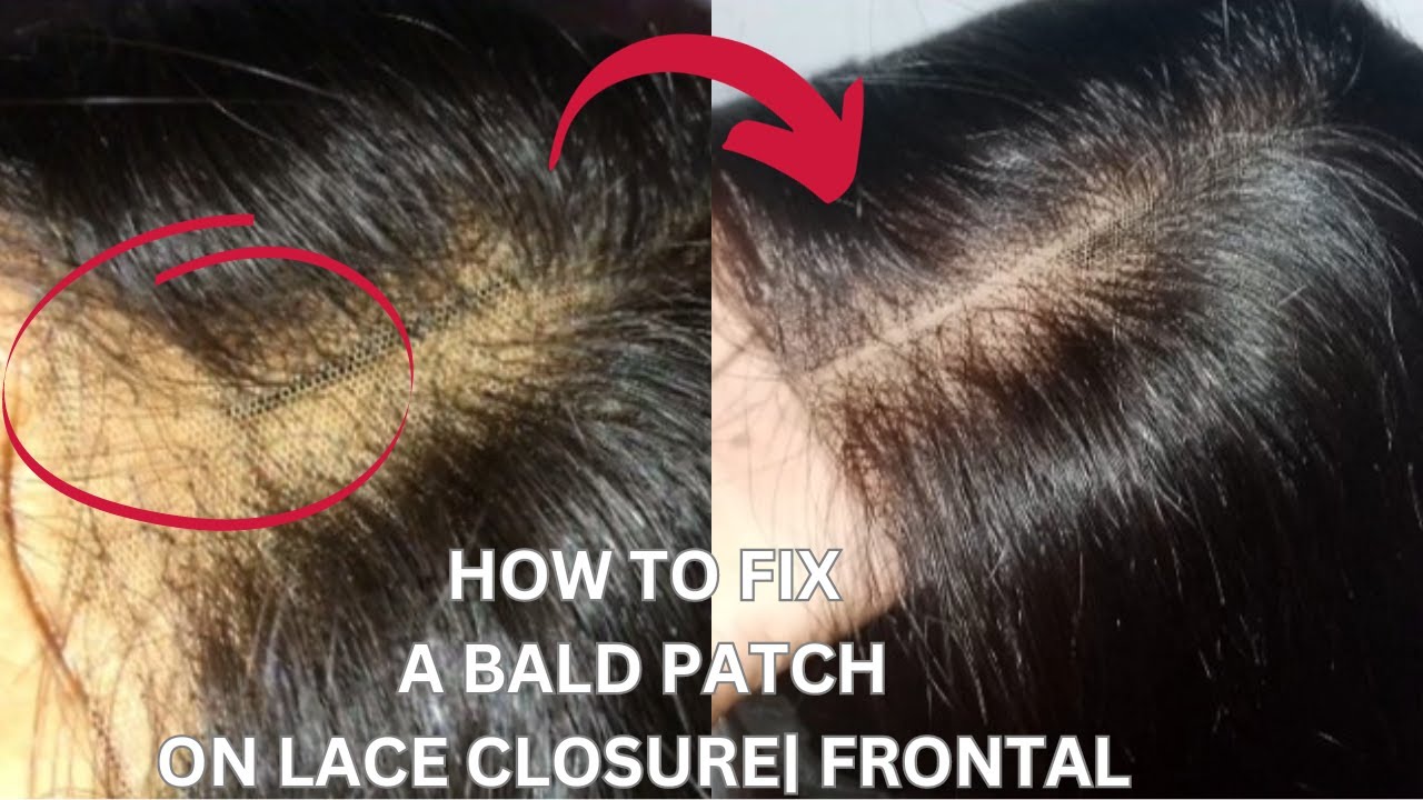 How To Fix Bald Patch On Lace Closure |Frontal #howto #diy #closure