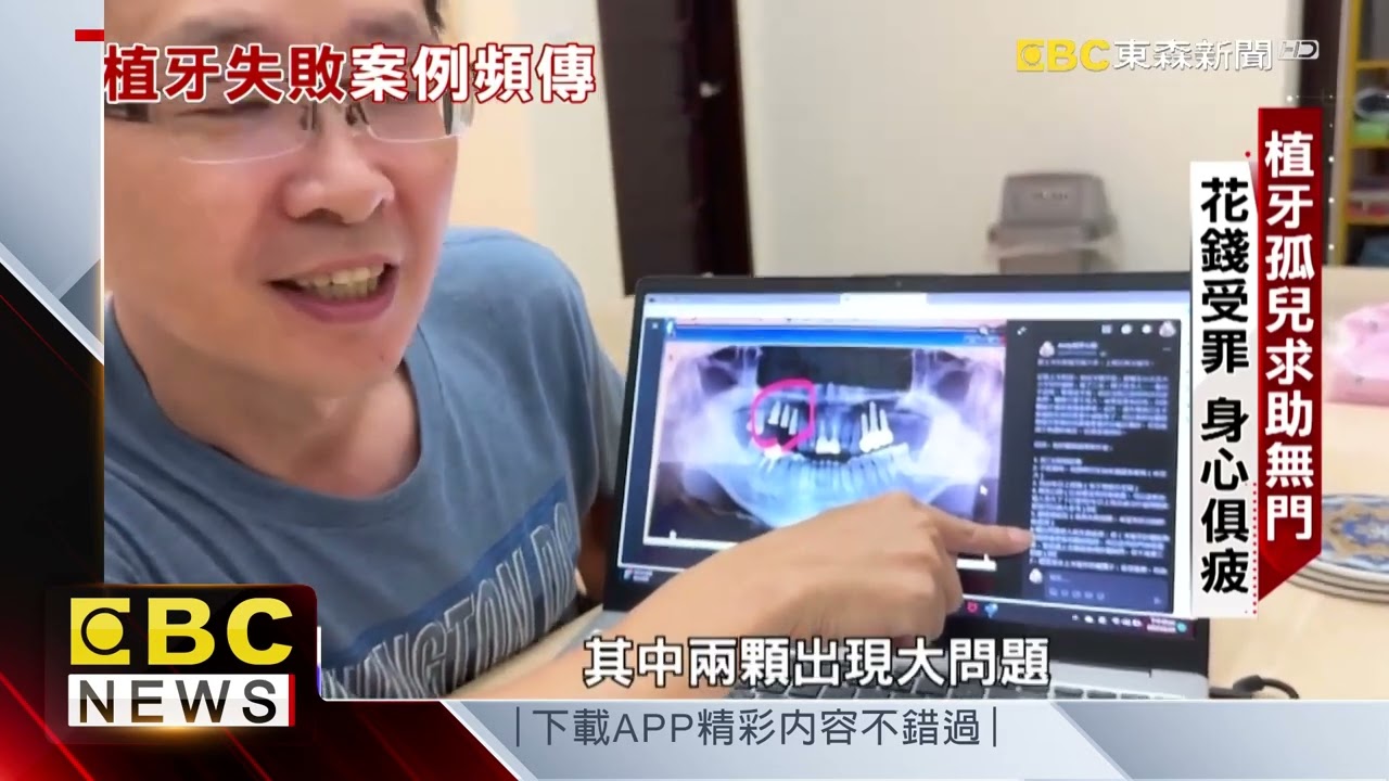 【聚焦真相】植牙孤兒慘碰壁！ 牙根碎裂求助無門 温硯鈞 吳宜霖 曾于馨 @newsebc