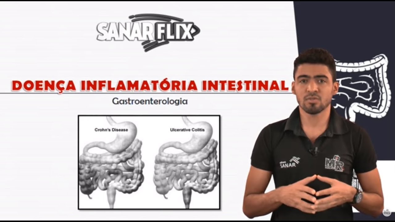 Doen&ccedil;as inflamat&oacute;rias intestinais - Doen&ccedil;a de Crohn e Retocolite Ulcerativa - Aula SanarFlix