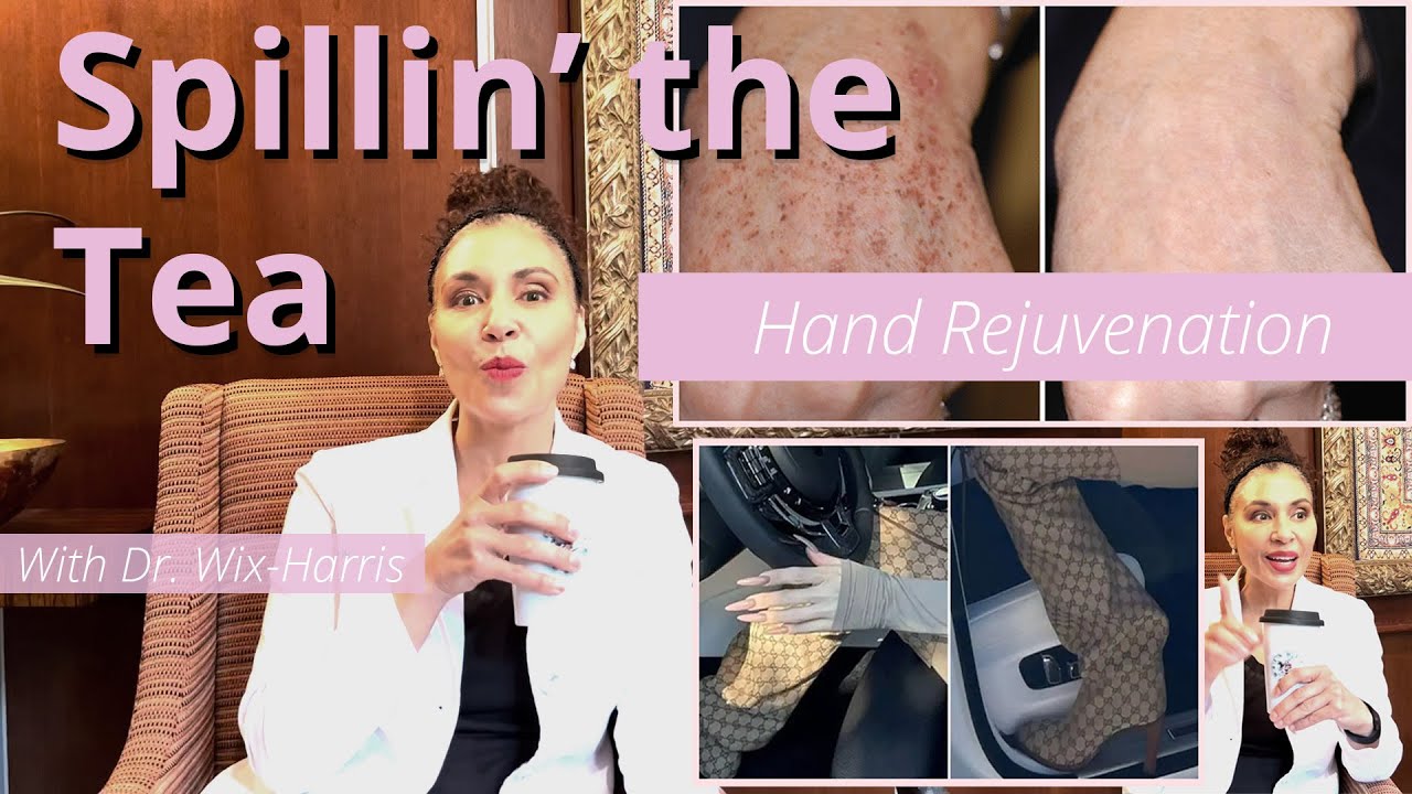 Dr. Renata Wix-Harris | Spillin' the Tea on #AntiAging of the Hands!