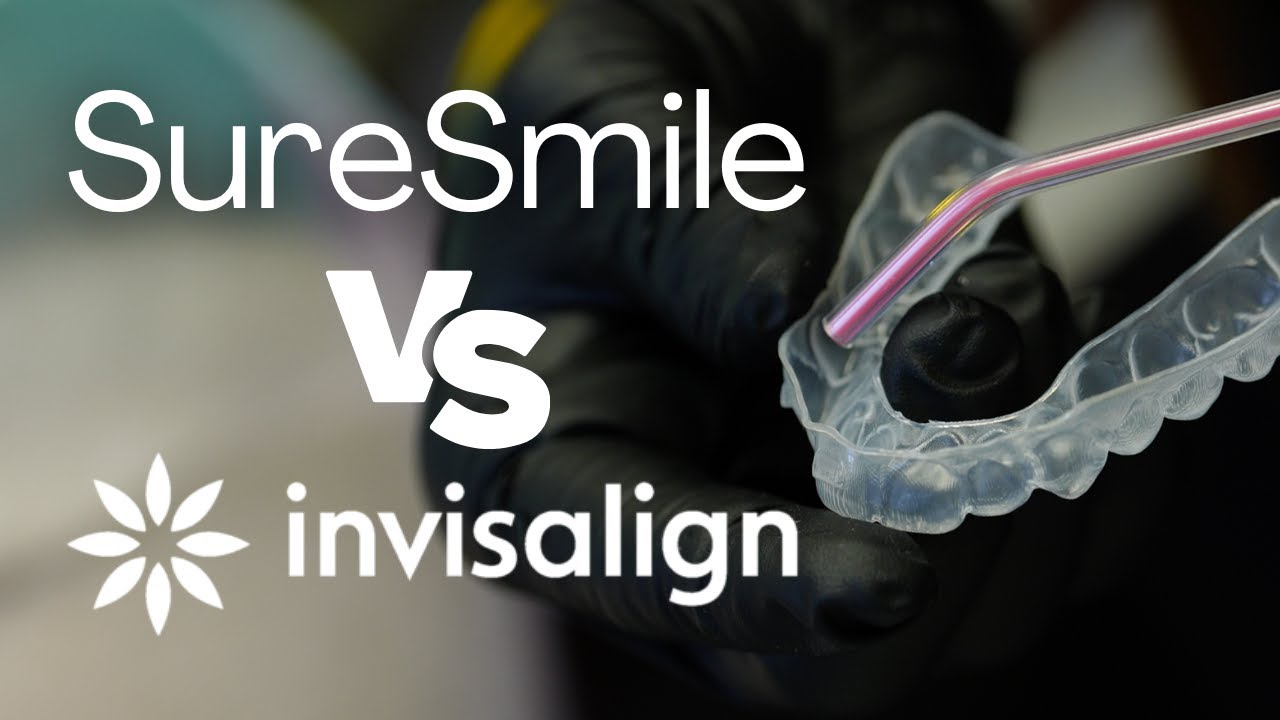 Suresmile vs Invisalign: Which ONE is Right for You?