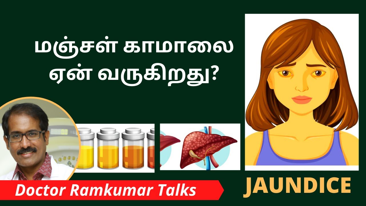 What Causes Jaundice? How? மஞ்சள் காமாலை ஏன் எதனால் வருகிறது? காரணங்கள், வகைகள் என்ன? / Dr Ramkumar