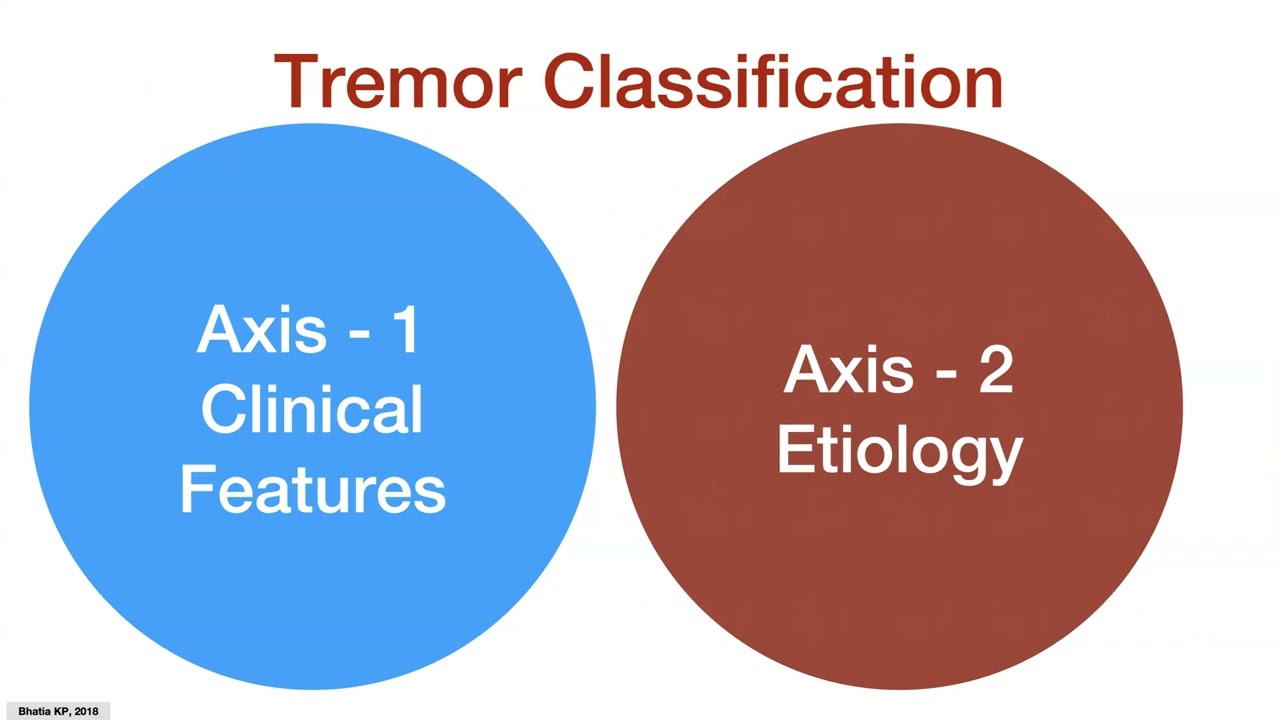 Approach to Tremors: Expert Insights from 1998 and 2018 Consensus statement (Brief)