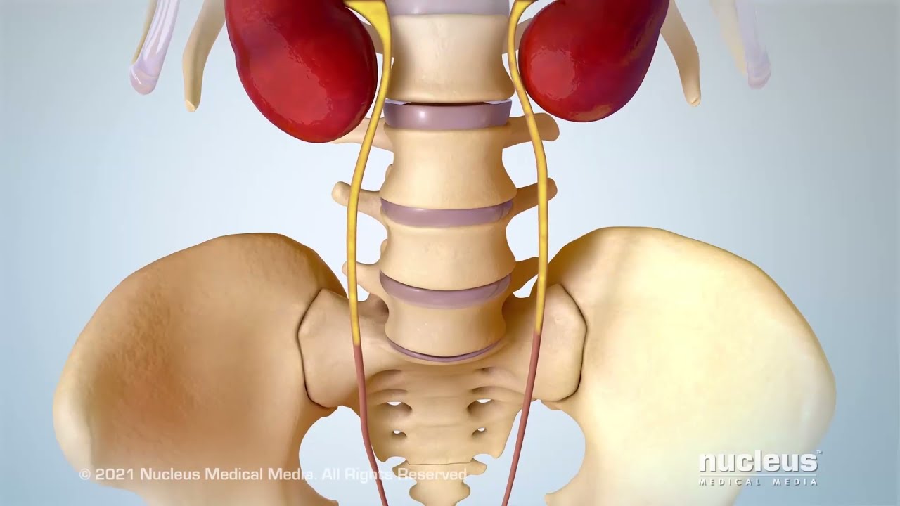 Stress Urinary Incontinence (SUI)