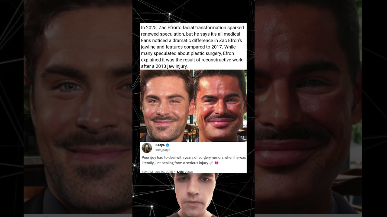 In 2025, Zac Efron’s facial transformation sparked renewed speculation
