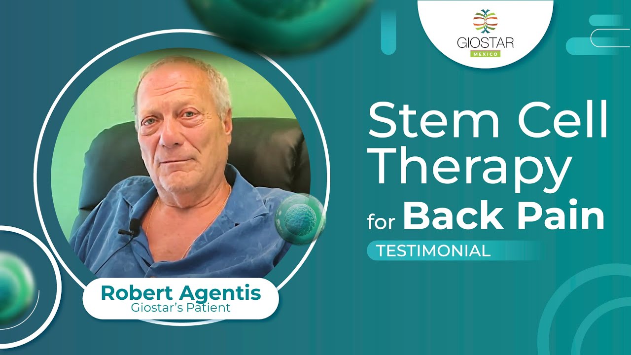Stem Cell Therapy For Back Pain - Giostar Mexico