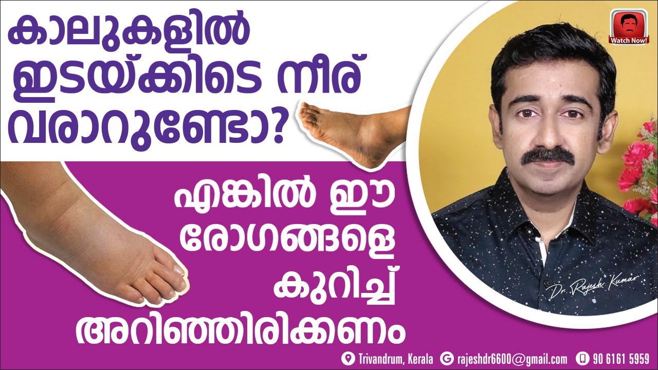 പാദത്തിൽ ഇടയ്ക്കിടെ നീര് വരാറുണ്ടോ ? എങ്കിൽ ഈ രോഗങ്ങളെ കുറിച്ച് അറിഞ്ഞിരിക്കണം