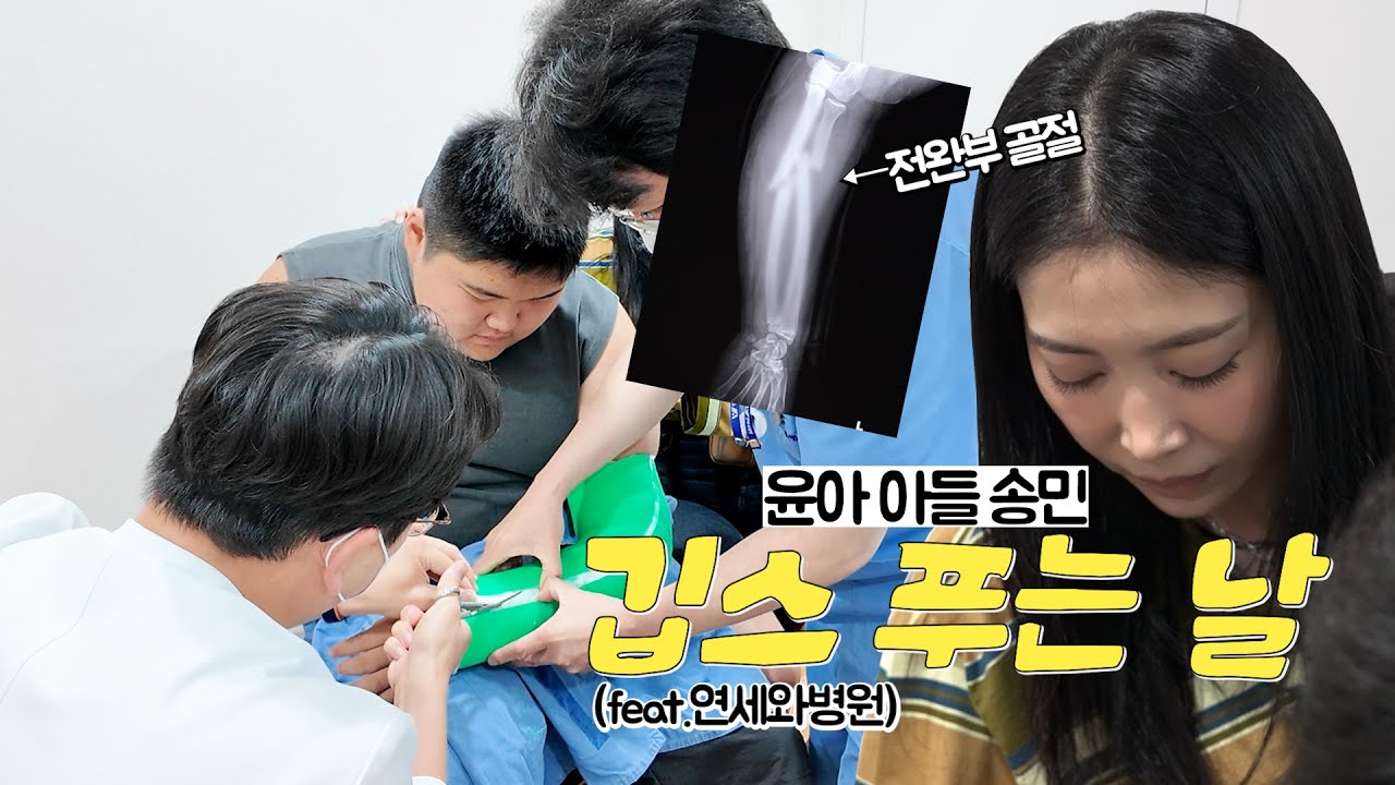 [Oh!윤아] 생각보다 심했던 오윤아 아들 송민 팔 골절 상태 ㅠㅜ