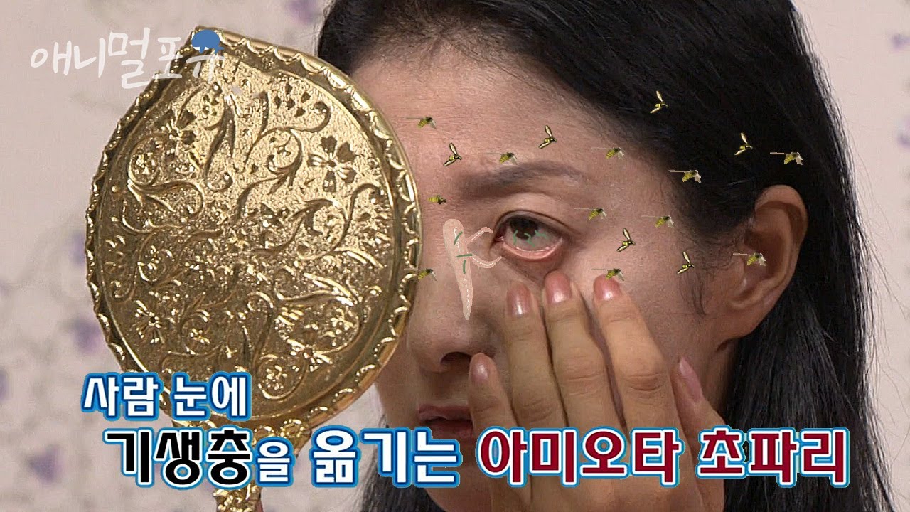 시청자 요청🚛 기생충이 내 눈 속에..?!! 실명을 일으킬 수 있는 초파리의 위험성 ㄷㄷ; l KBS 위기탈출 넘버원 120903 방송