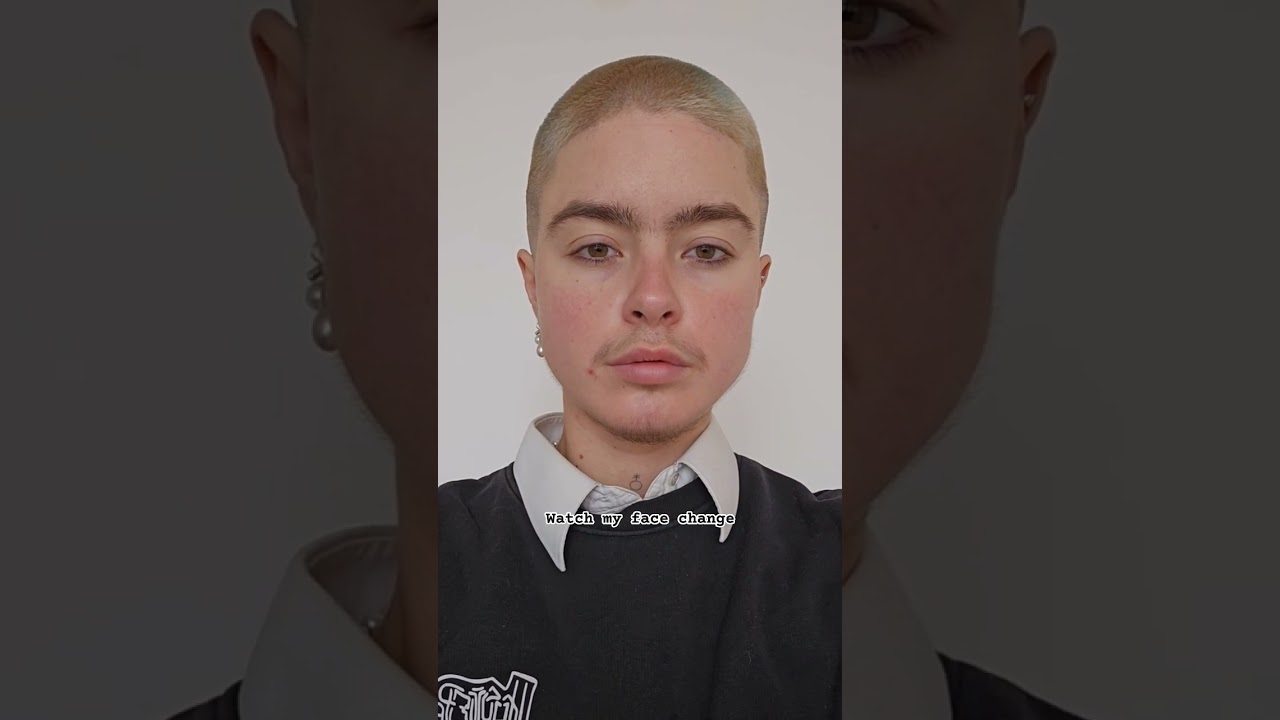 facial change on Testo 🫶 #testosterone #trans #nonbinary