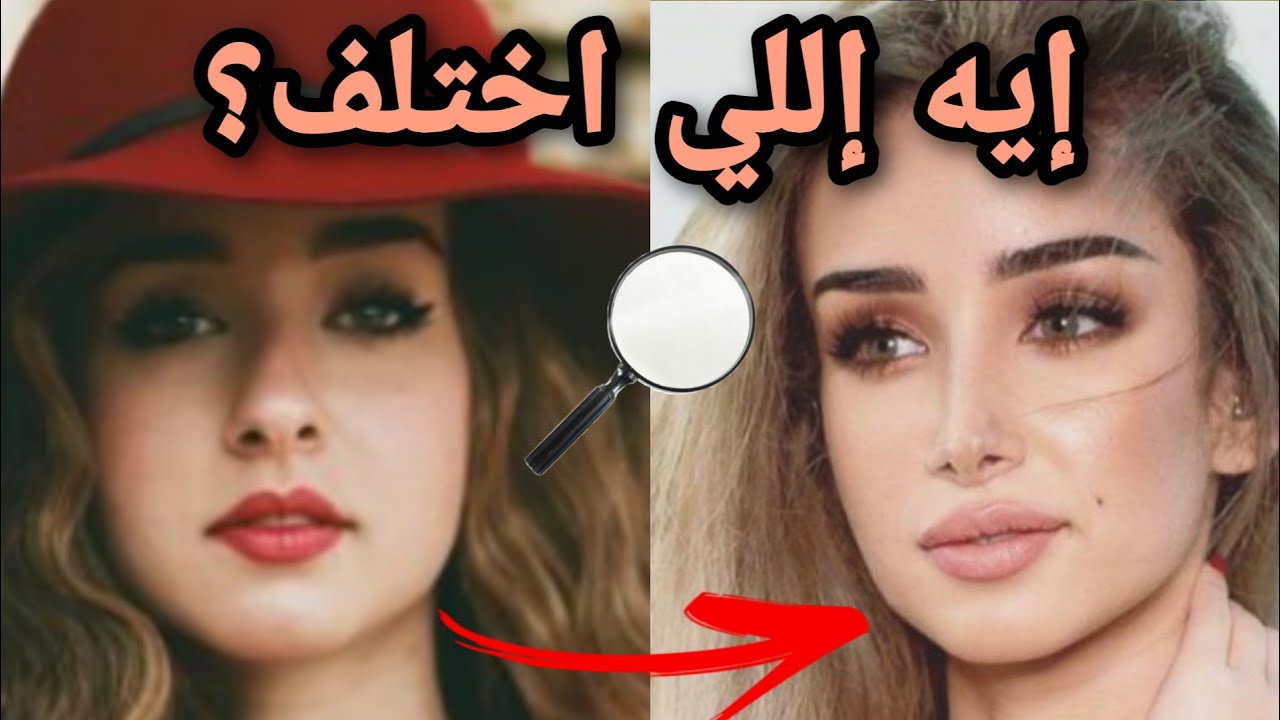دكتور يوضح : هل خضعت هنا الزاهد لعمليات تجميل ؟