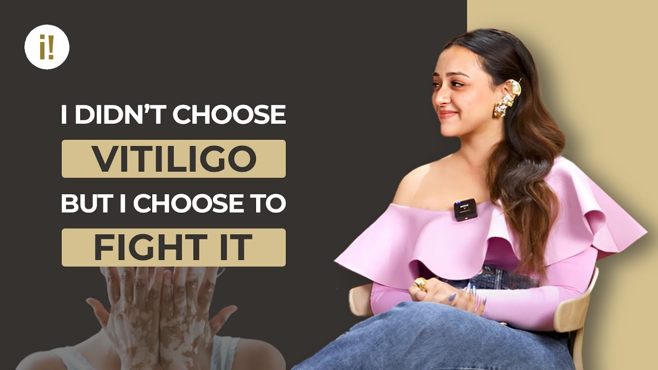 Vitiligo Didn’t Win — I Did | in a swank way with Tushar Mestry
