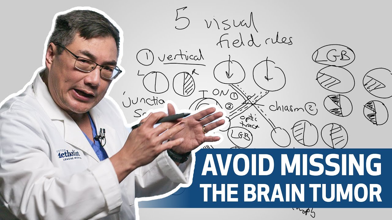 Five Visual Field Rules to Identify Brain Tumor | Houston Methodist